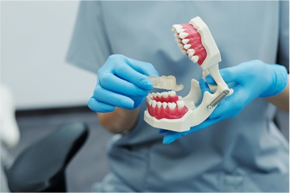 牙科磁性附屬體